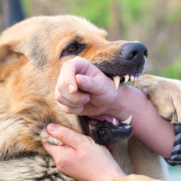 7 Common Types Of Dog Bite Injuries Explained Image for 7 Common Types Of Dog Bite Injuries Explained post