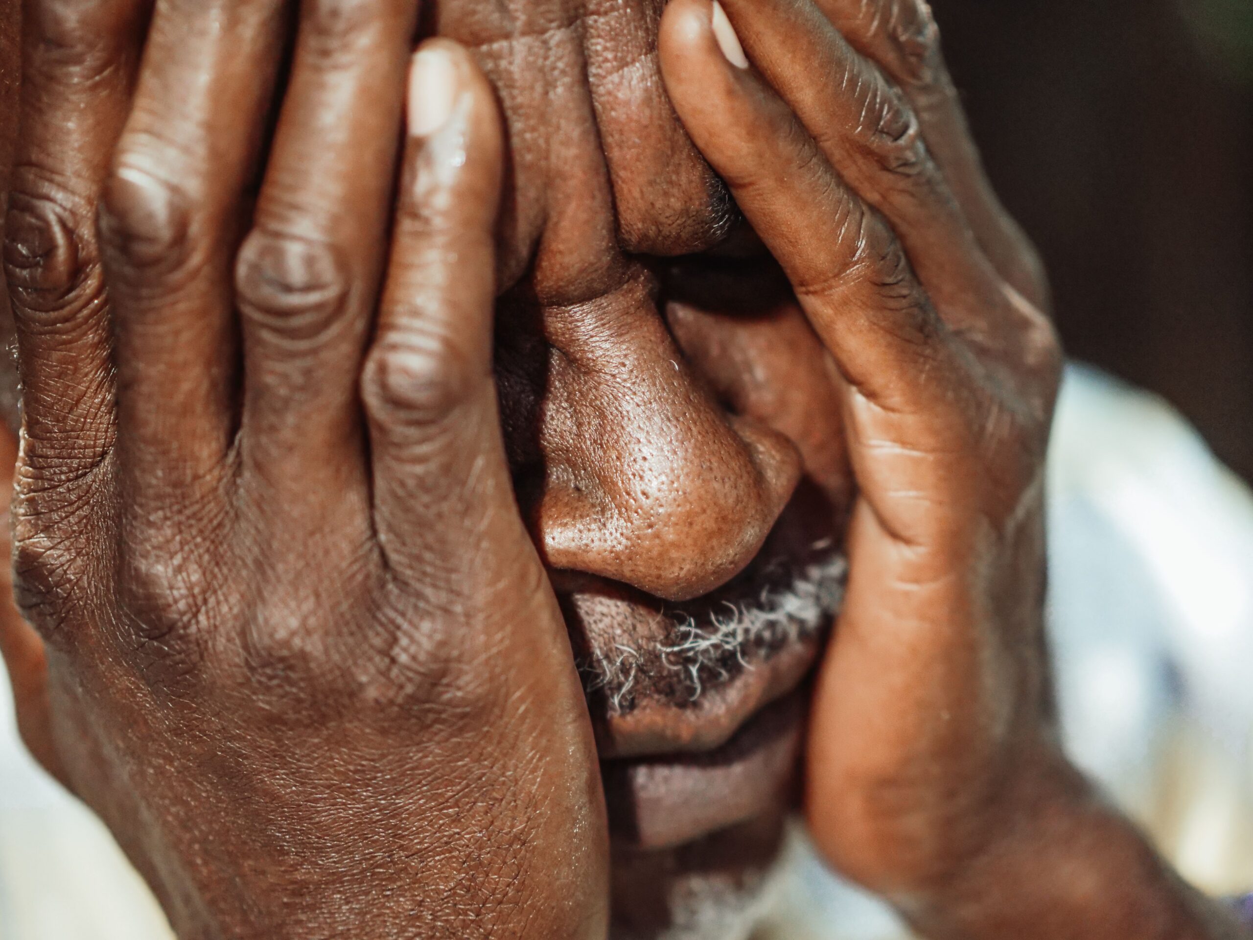 Cloe up of Black man holding his face in pain